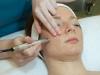 Microdermabrasion is a treatment programme that delivers results at About face